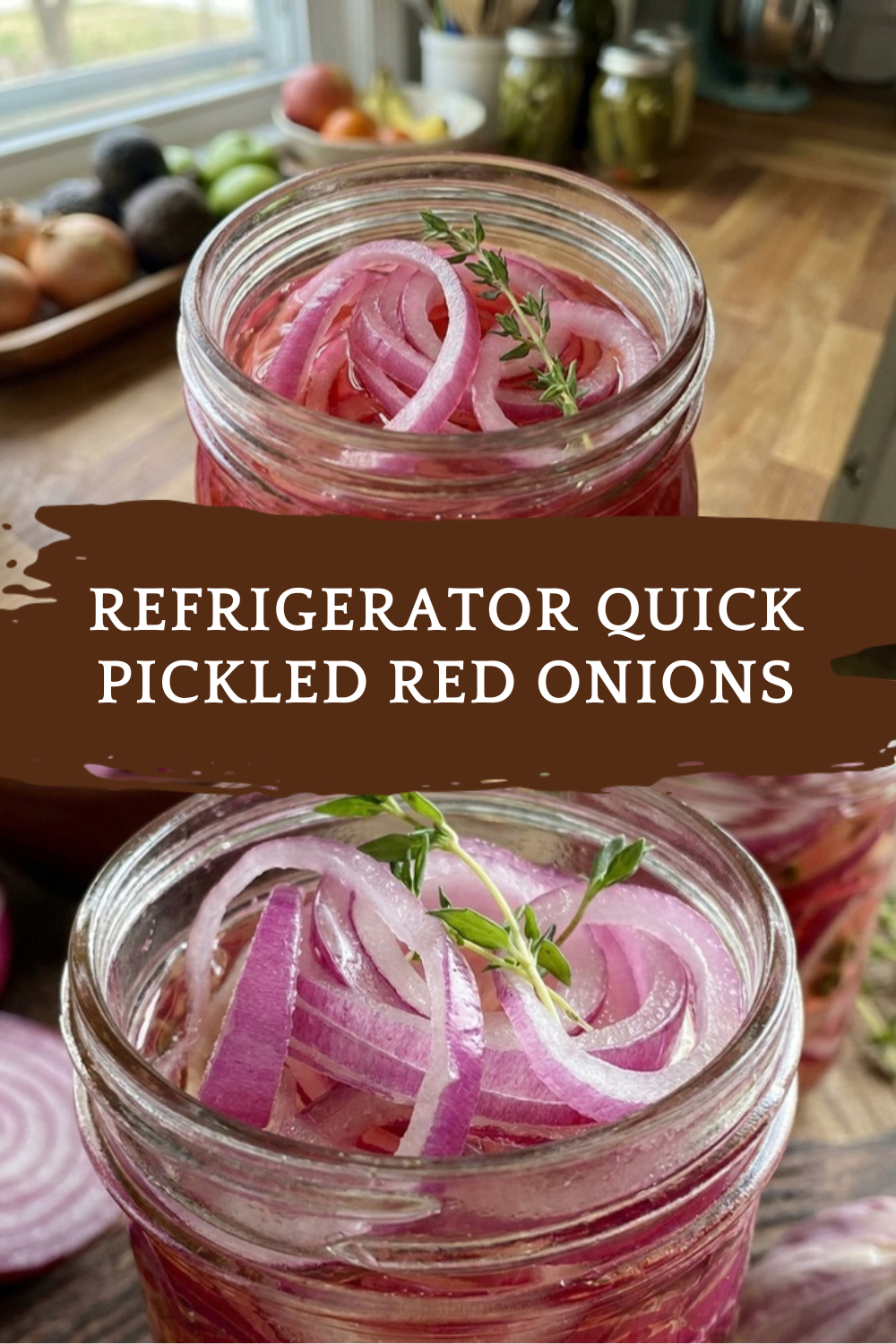 Refrigerator Quick Pickled Red Onions